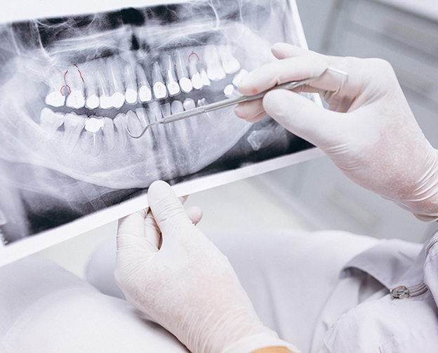 Plan de traitement personnalisé